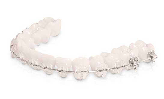 Ortodontia e Ortopedia Facial